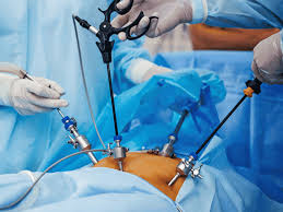 Laparoscopic Urology